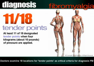 fibromyalgia treatment